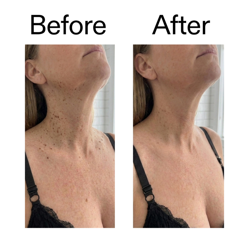 Levora Exfoliating Body Stick